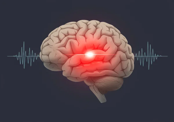 Amygdala as brain's alarm system glowing red